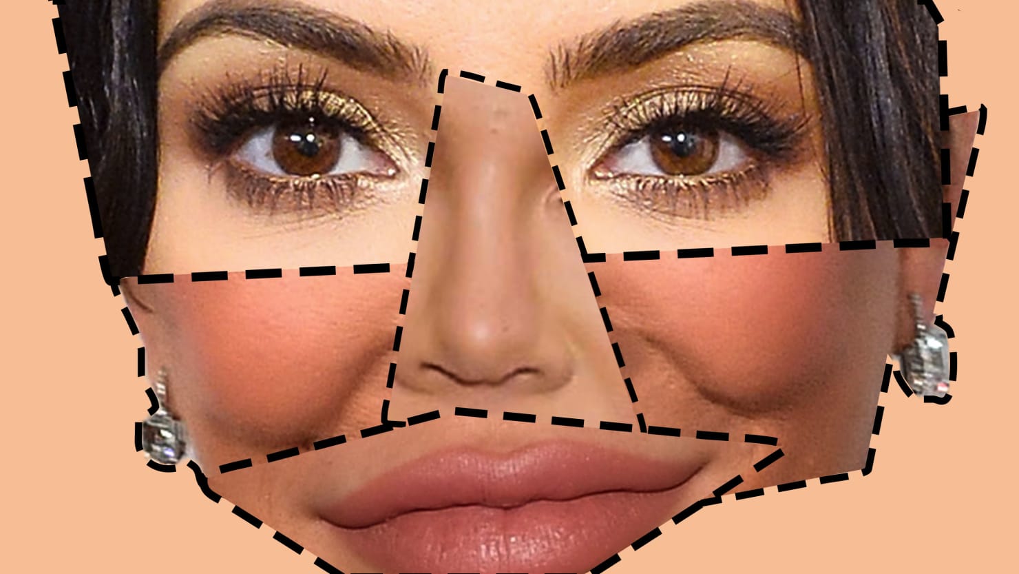 Kardashian đã thay đổi khuôn mặt như thế nào sau phẫu thuật thẩm mỹ
