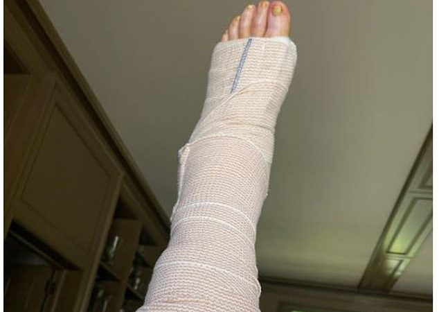 Về chữa bệnh: Martha Stewart hồi phục tại nhà sau khi trải qua cuộc phẫu thuật kéo dài ba giờ để sửa lại gân Achilles bị đứt