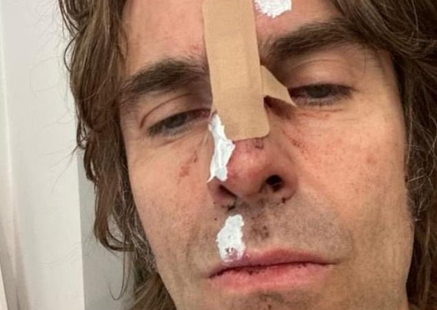 'Có ảnh bìa cho album sắp phát hành': Liam Gallagher khiến người hâm mộ sốc với một bức ảnh tự sướng gây sốc vào thứ Hai khi anh tiết lộ rằng anh đã rơi khỏi máy bay trực thăng sau một bữa tiệc lễ hội Isle of Wight