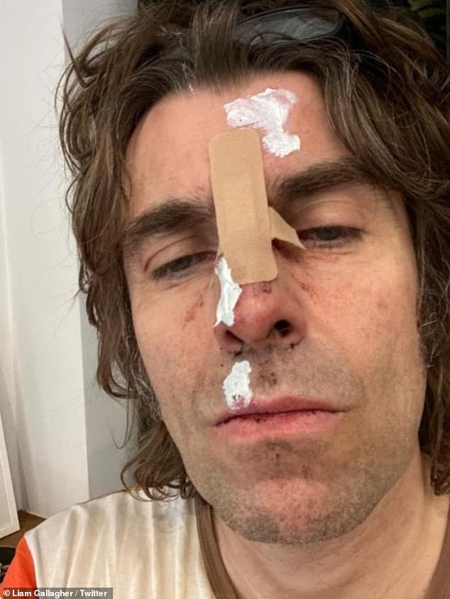 'Có ảnh bìa cho album sắp phát hành': Liam Gallagher khiến người hâm mộ sốc với một bức ảnh tự sướng gây sốc vào thứ Hai khi anh tiết lộ rằng anh đã rơi khỏi máy bay trực thăng sau một bữa tiệc lễ hội Isle of Wight